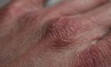 image_18494